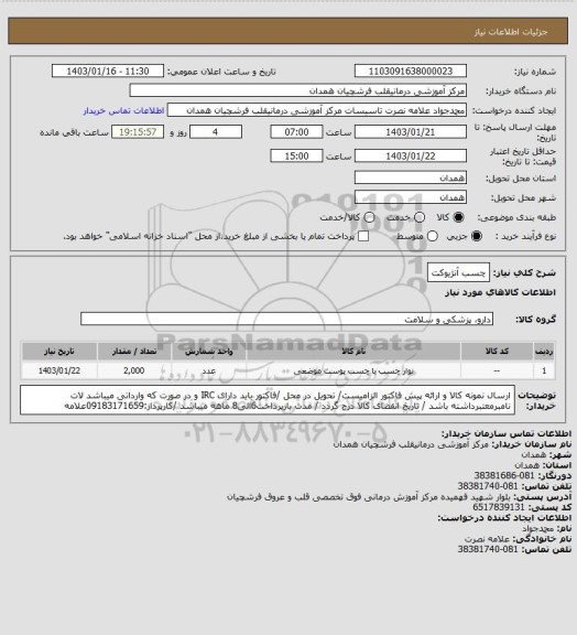 استعلام چسب آنژیوکت