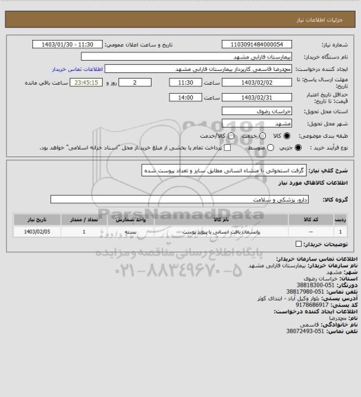 استعلام گرفت استخوانی  با منشاء انسانی مطابق سایز و تعداد پیوست شده