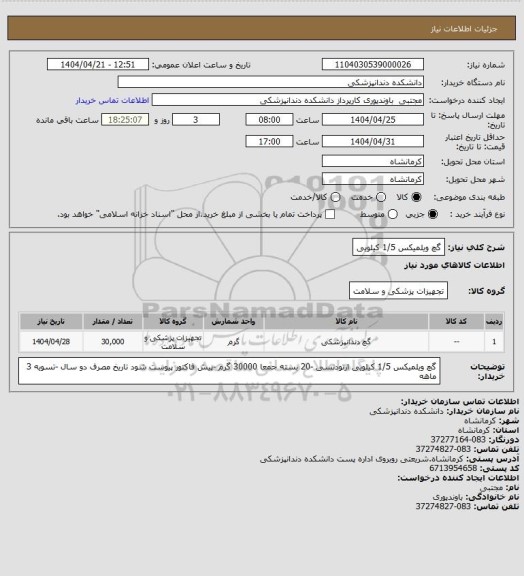 استعلام گچ ویلمیکس 1/5 کیلویی