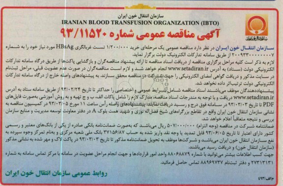 خرید 1.200.000 تست غربالگری HBSAG