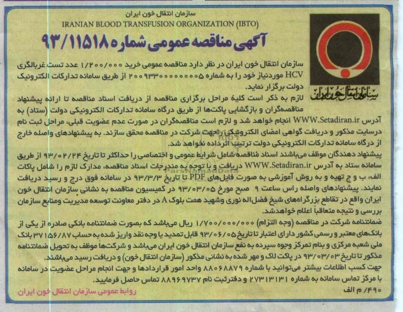 خرید 1.200.000 عدد تست غربالگری HCV 