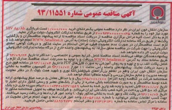 خرید 1.000.000 تست غربالگری HIV AG/AB مناقصه عمومی , مناقصه 
