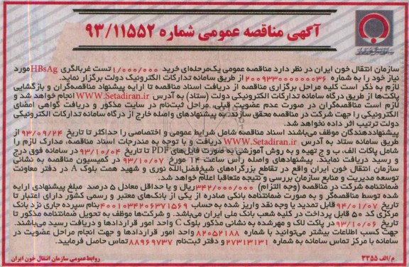  خرید 1.000.000 تست غربالگری HBsAg مناقصه عمومی , مناقصه 