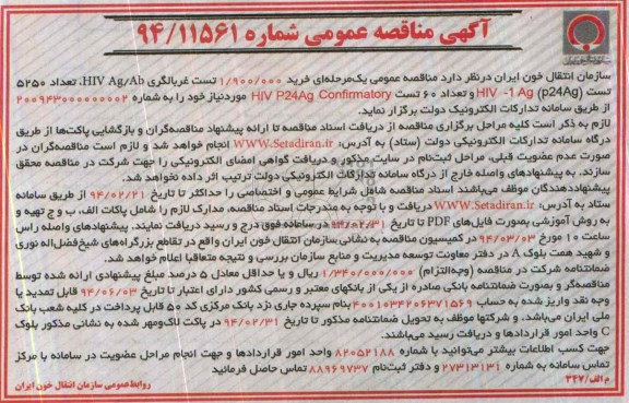 خرید 1.900.000 تست غربالگری HIV AG/AB تعداد 5250 تست (P24AG) HIV-1 AGمناقصه , مناقصه 