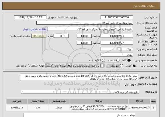 استعلام سایز e2 تا e5 چپ و راست بالا و پایین از هر کدام 10 عدد و سایز d2 تا d5  چپ و راست بالا و پایین از هر کدام 10 عدد جهت دندان های شیری اطفال 